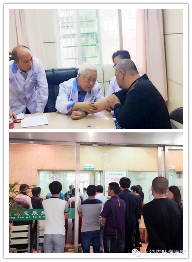 王俠生教授在上饒皮膚病醫(yī)院會診